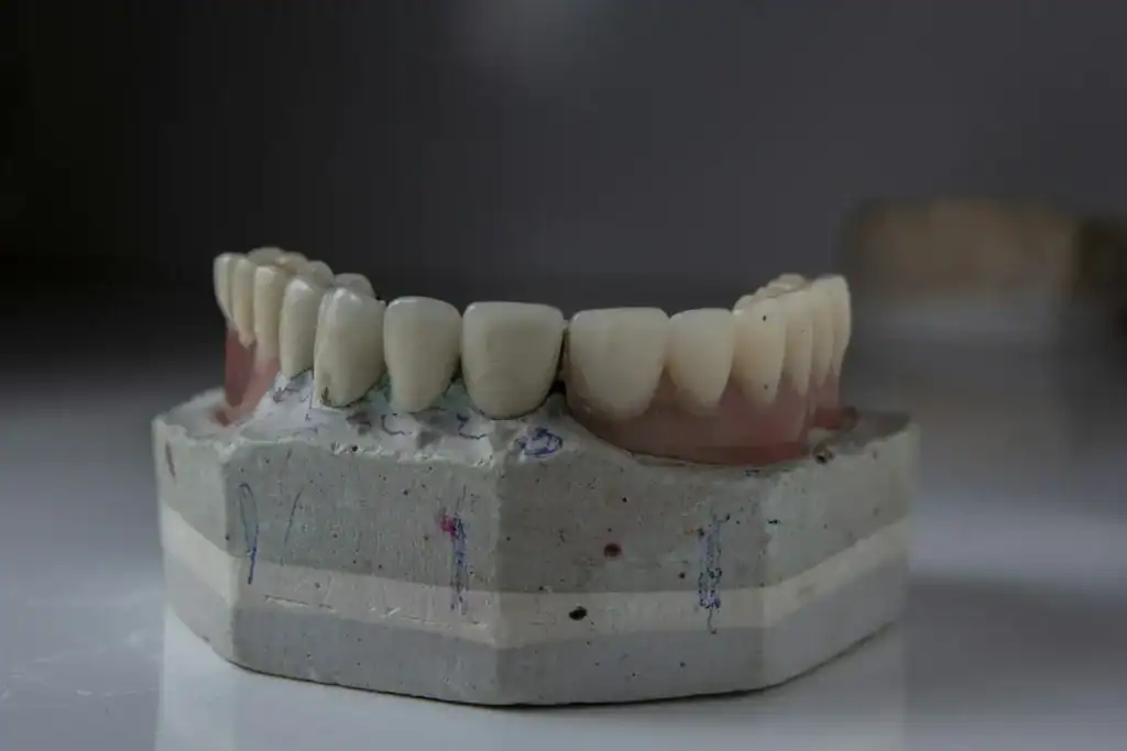 A full arch of replacement teeth on a plaster model