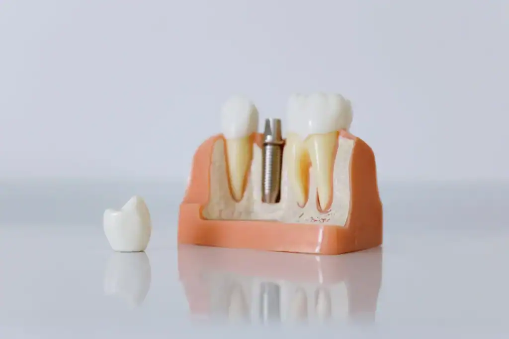 A dental implant teaching model next to a single crown