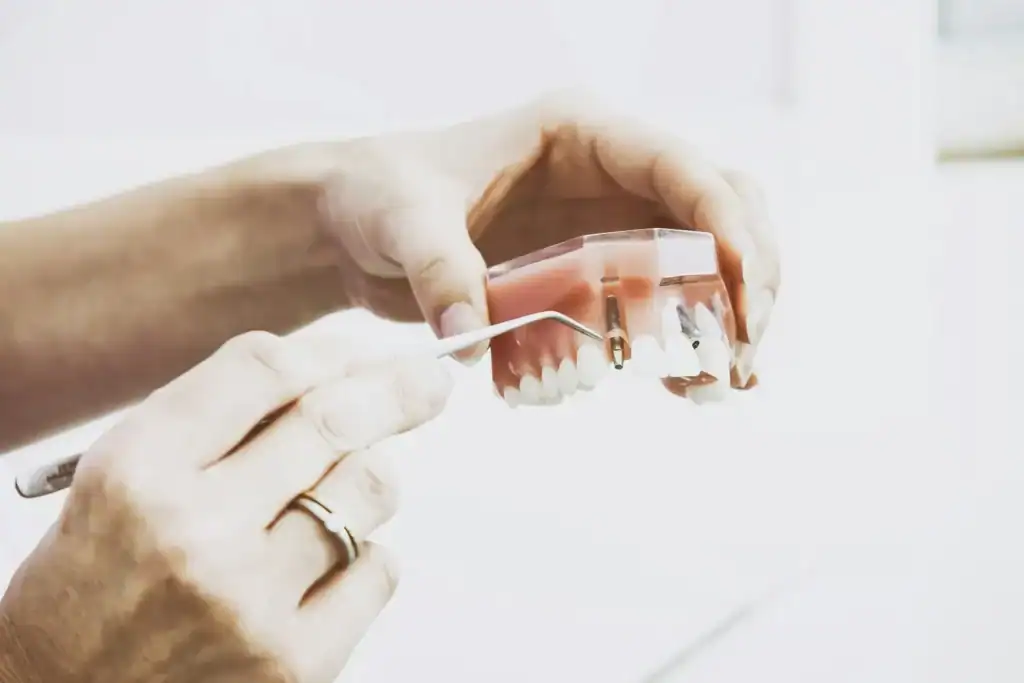 Hands holding a model of a denture fixed onto implants