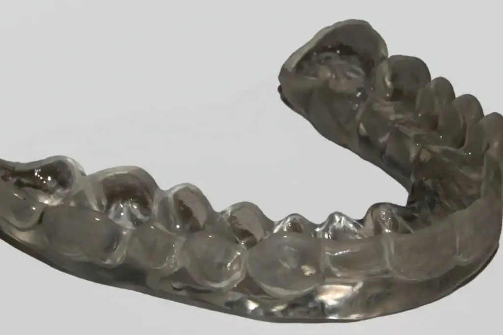 A custom-made splint shaped to the upper teeth