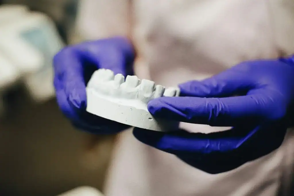 Gloved hands holding a plaster model of the lower teeth