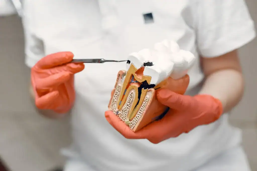 A gloved hand pointing to a cross-section model of a tooth and its root canals