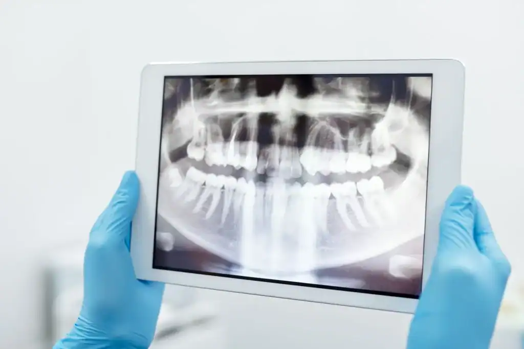 Gloved hands holding a tablet showing a panoramic dental X-ray