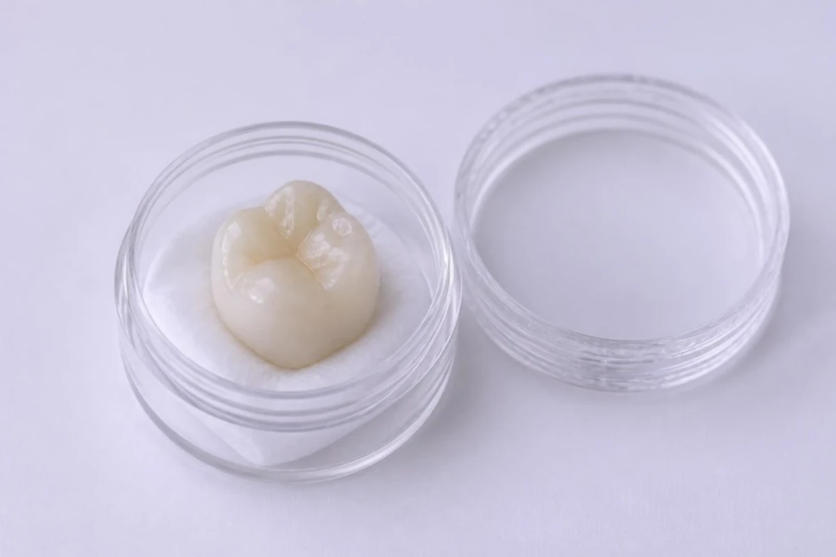 3D插图:牙冠直立放在透明盒中的小垫上,咬合面朝上,盒盖放在一旁