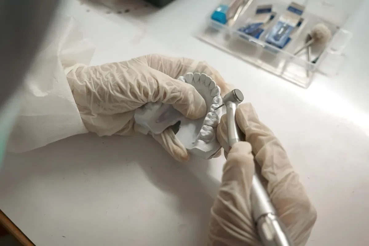 牙科技师在技工室的模型上打磨局部义齿的金属支架