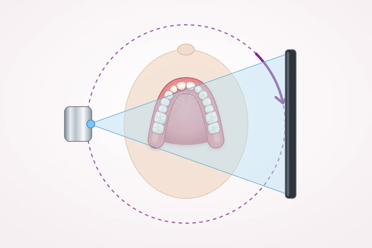 插图(俯视):CBCT 扫描时锥形 X 射线束穿过头部到达探测器,机器绕头部旋转一圈
