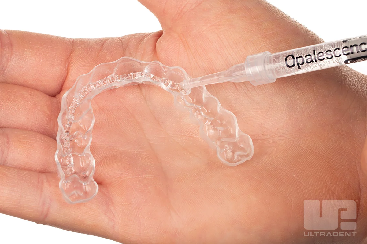 Ultradent 官方图片:放在手掌上的透明定制美白牙托,正从注射器向牙托内挤入 Opalescence 凝胶