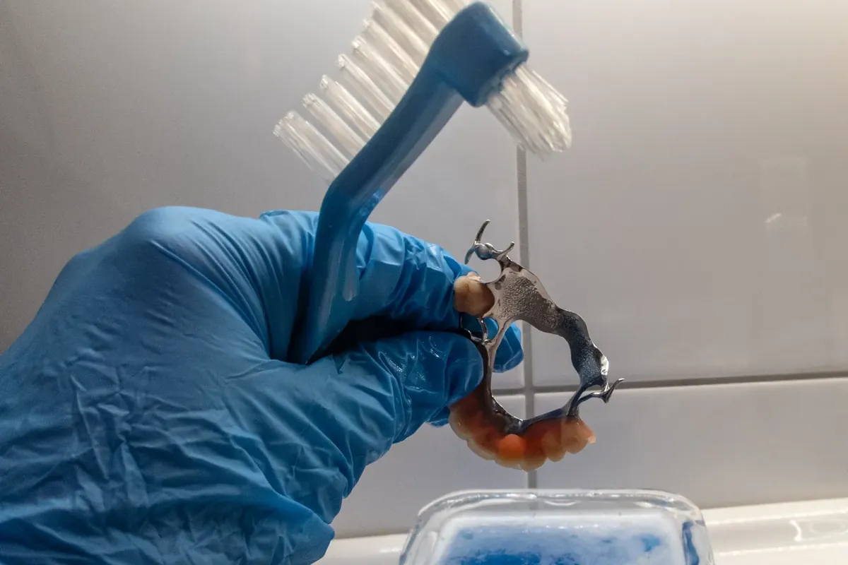 戴手套的手拿着钴铬支架局部假牙和假牙刷,下方是一盒清洁液