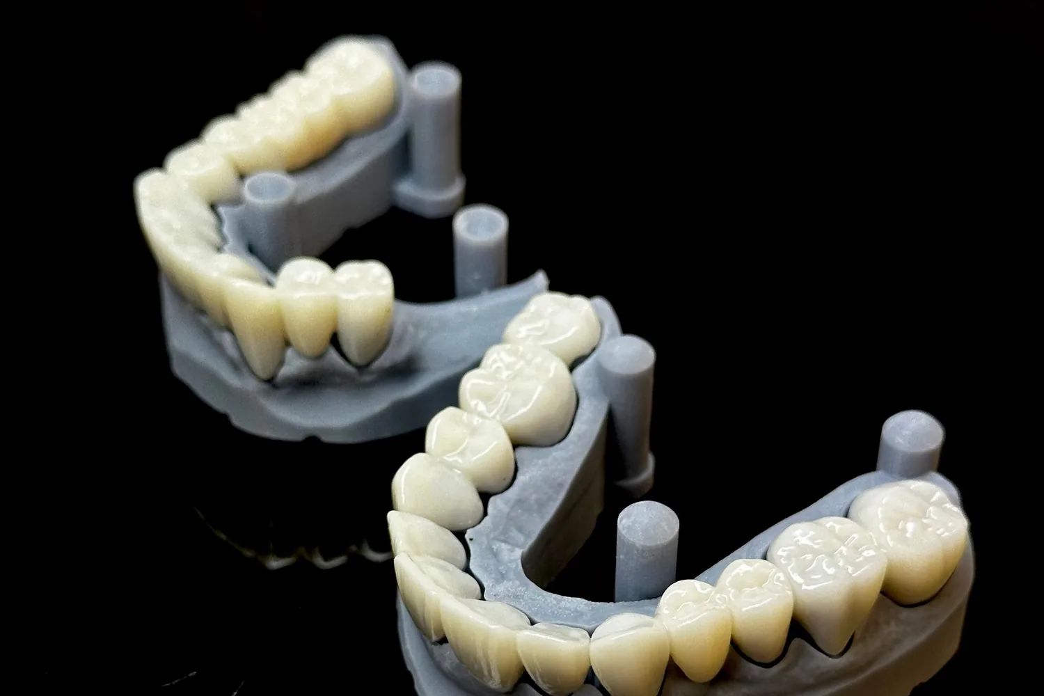 3D-printed upper and lower dental models with a full set of planned restorations