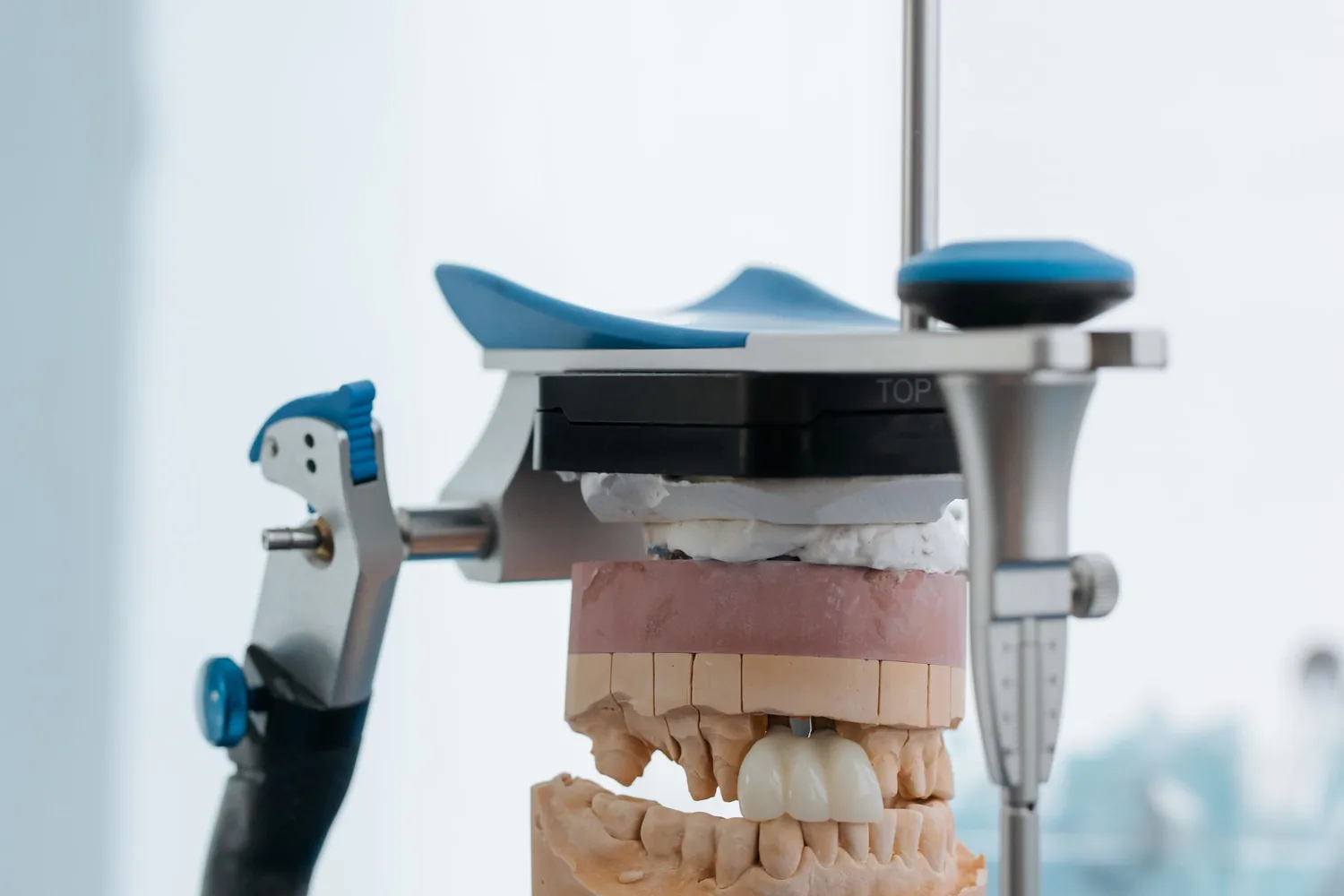 Upper and lower dental models mounted in a dental articulator to check how the teeth meet
